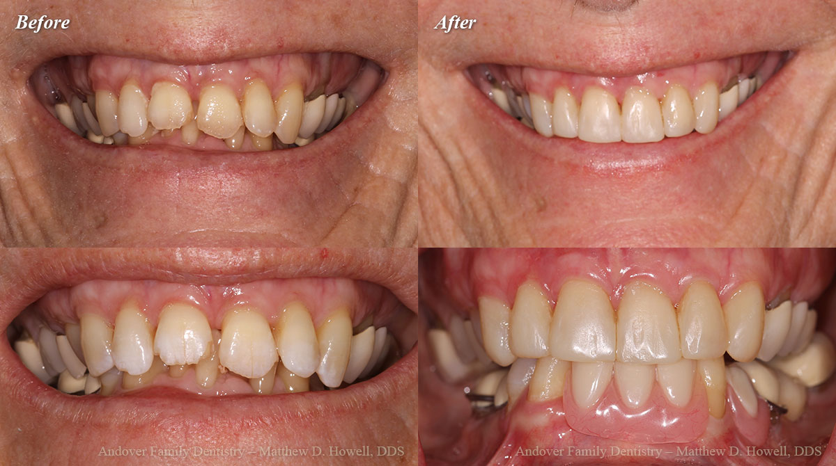 Smile Gallery Wichita Dental Andover Family Dentistry