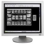 Digital X-ray Dental Technology at Andover Family Dentistry - Dentist in Andover, KS